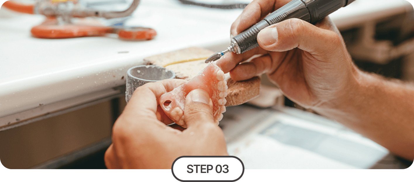 식립 및 보철 제작