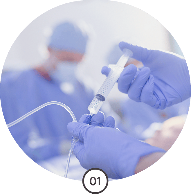 마취액 주입 압력