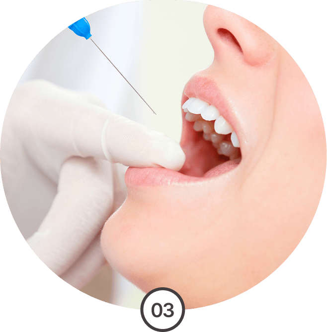 주사 바늘 자극