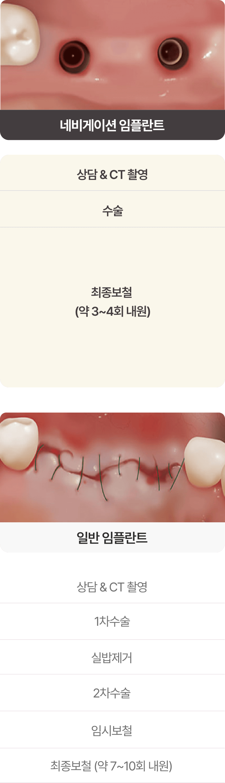 네비게이션 임플란트와 일반 임플란트의 차이점