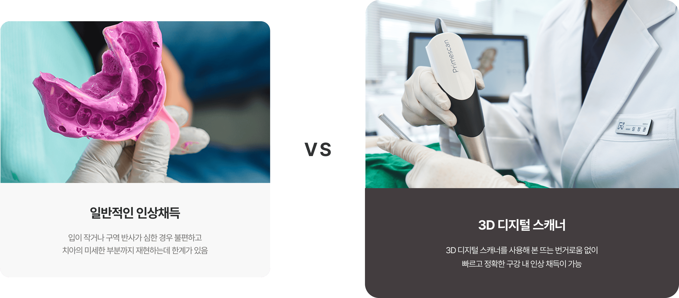 일반적인 인상채득과 3D 디지털 스캐너의 차이