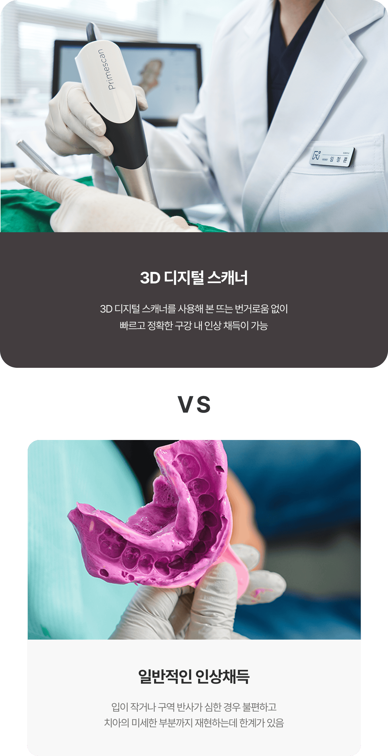 일반적인 인상채득과 3D 디지털 스캐너의 차이
